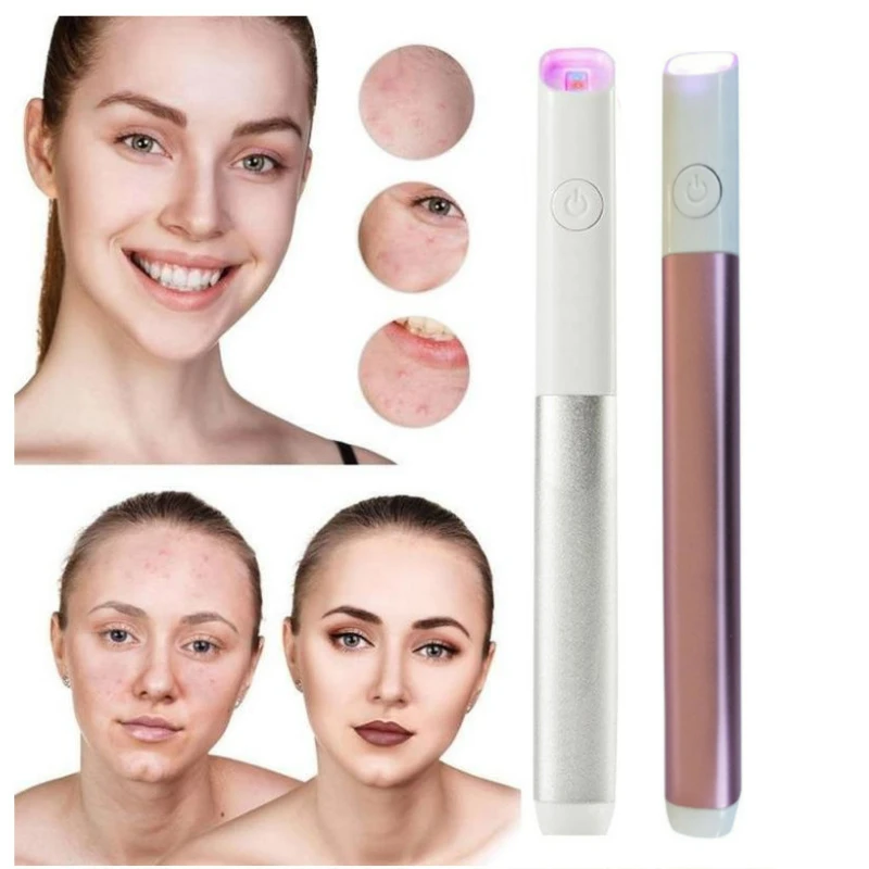 

Лазерная ручка для лечения пятен и прыщей, портативный аппарат для удаления морщин с голусветильник том