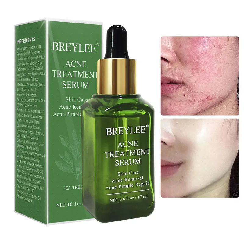 

BREYLEE Acne Treatment Face Serum Mask Anti Acne Pimple Scar Remover Moisturizing Whitening Skin Care Facial Essence Cream 17ml