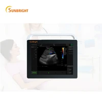 2d medical ultrasound instruments portable digital system ultrasound scan machine