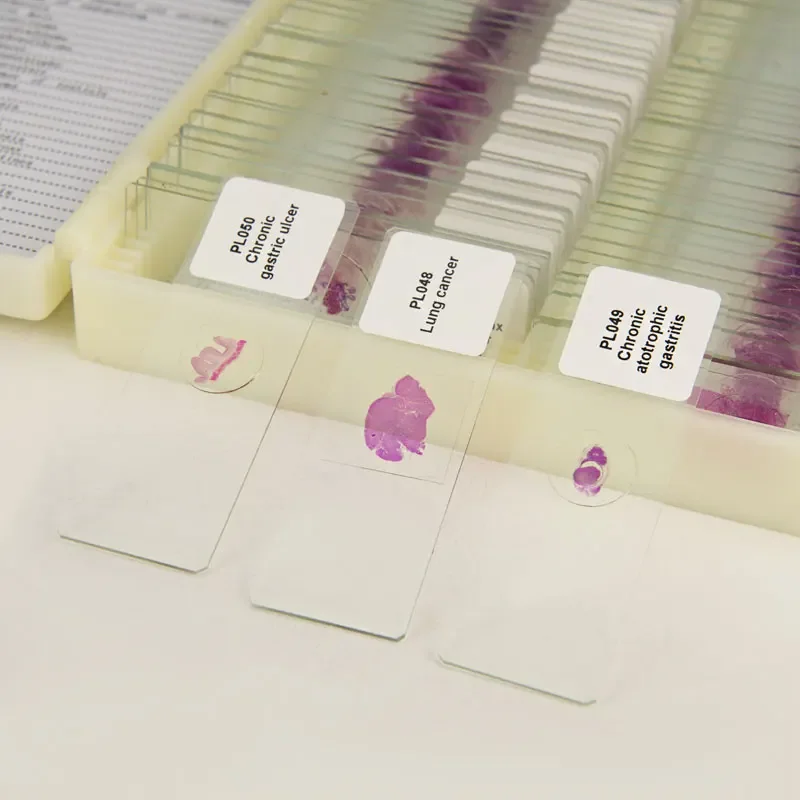 100 видов медицинских патологических секций человеческого тела типовые