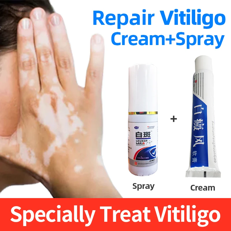 Медицинский Лечебный крем для лечения заболеваний пигмент витилиго лечение