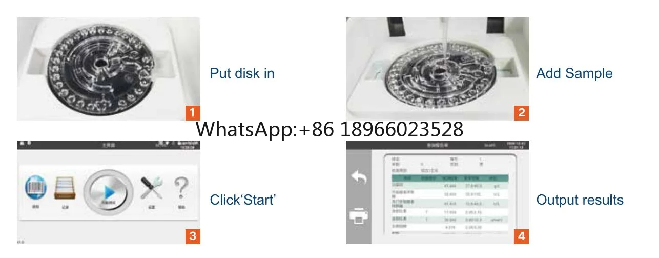 Высококачественный автоматический гематологический анализатор 3-компонентный