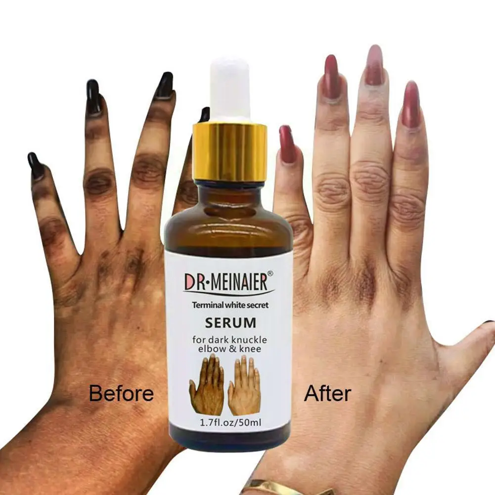 

50ml Strong Effective Whitening Serum Removing Dark Knee Hand Essence Elbow Joint Brightening Lighten Knuckle Finger & Skin X4O7