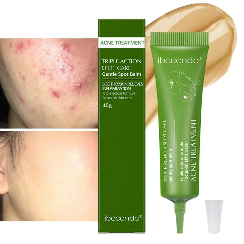 

Acnes Scar Removal Cream For Face Natural Organic Herbal Acnes Scars Removal Cream Scar Cream For Blackhead Repairing Acnes