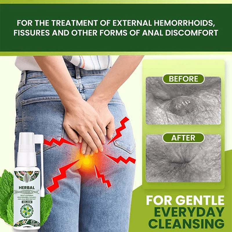 

30ml Natural Herbal Hemorrhoids Spray Powerful Hemorrhoids Treatment Agent