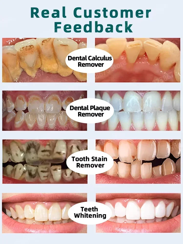 Le nettoyage des dents a un effet blanchissant Baş Σ les taches profondes Tooth Whiten Care