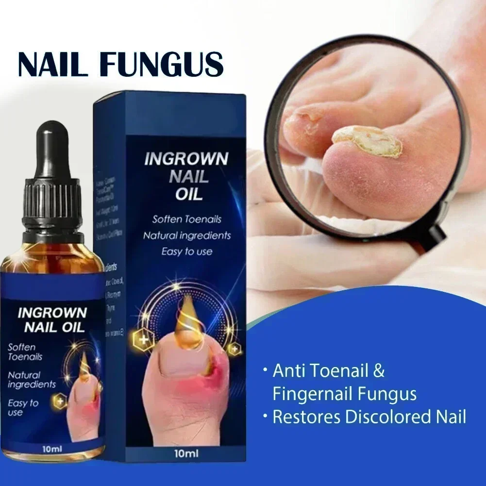 Восстанавливающий уход за ногтями и гель для удаления грибка на ногтях