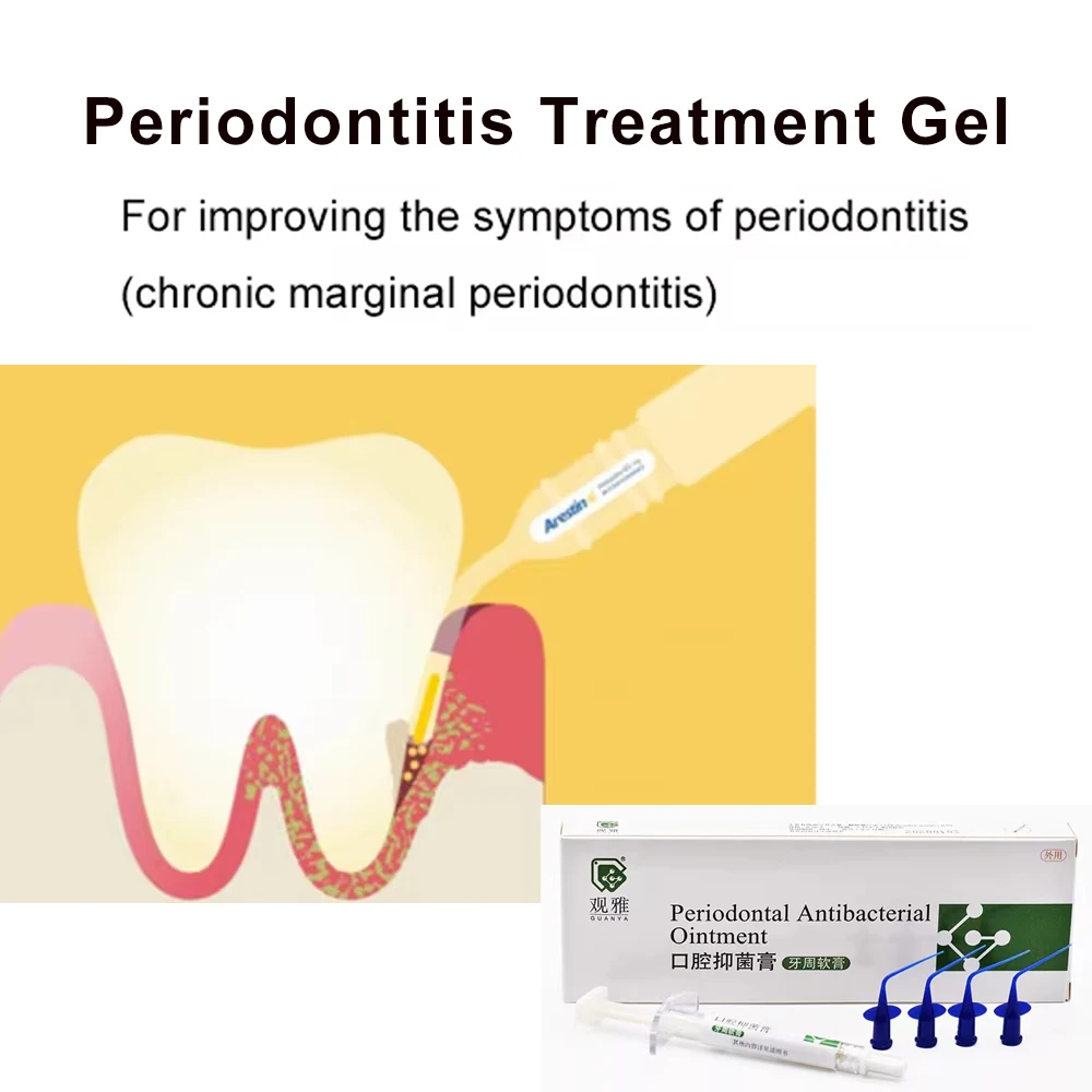 Стоматологические материалы гель для лечения заболеваний пародонта десны
