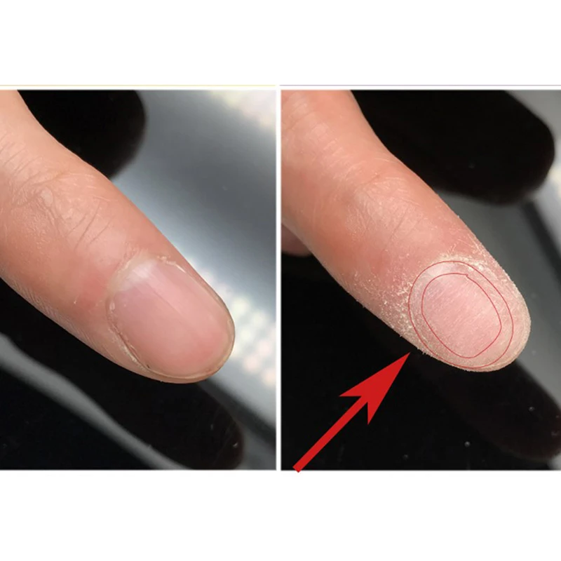 thumb