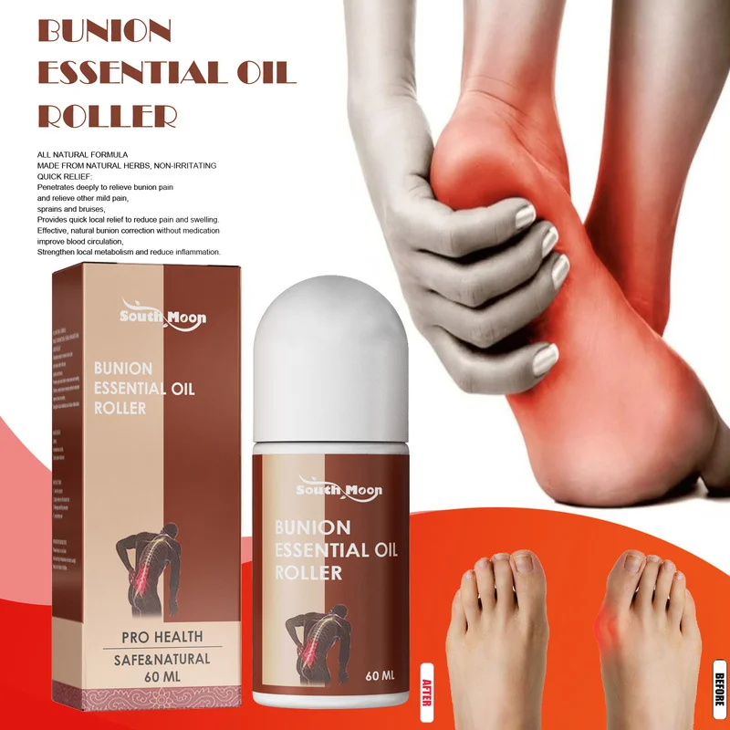 

Bunion Plant Saffron Essential Oil Roller Relief Ache Pain Treatment Deformity Abnormal Foot Toe Joint Correct Feet Massage Care