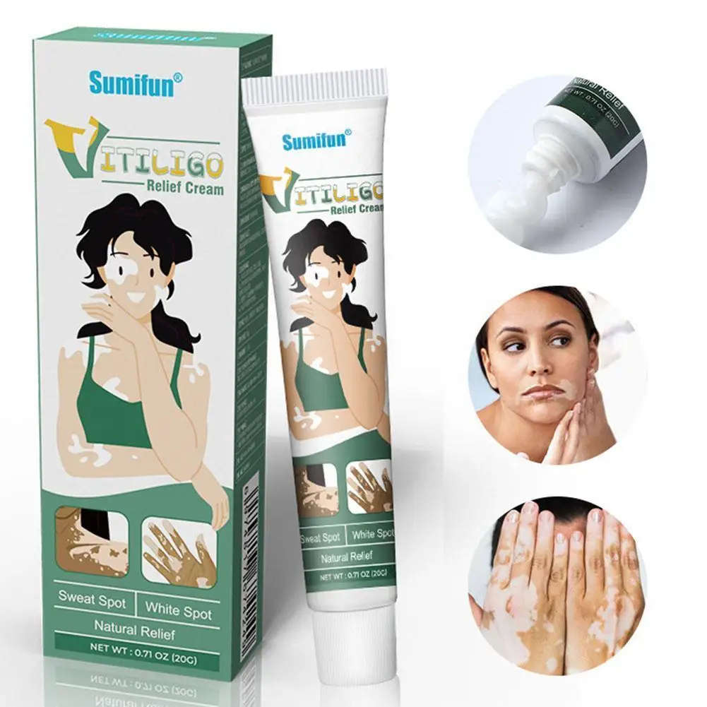 

Vitiligo Treatment Cream White Spot Antibacterial Ointment Localized Repair Herbs Leukoplakia Beauty Medical W5x5