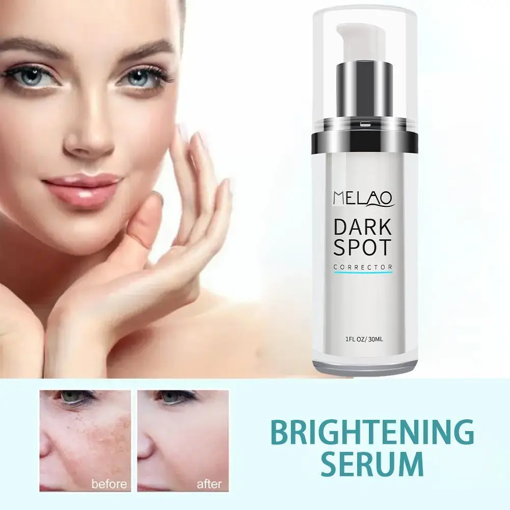 

Whitening Freckle Serum Removal Melasma Dark Spots Brighten Pigmentation 30ml Anti Skin Smooth Aging Nourish Care Moisturiz B3M7