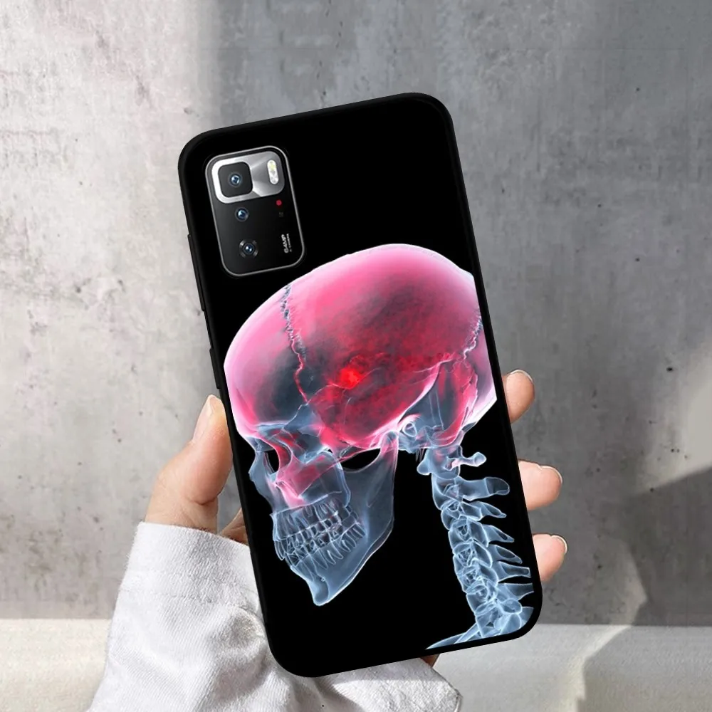 Радиологический каркас человеческих органов телефон планшетофон X 5 A 6 7 8 Pro T9 9S 10 11