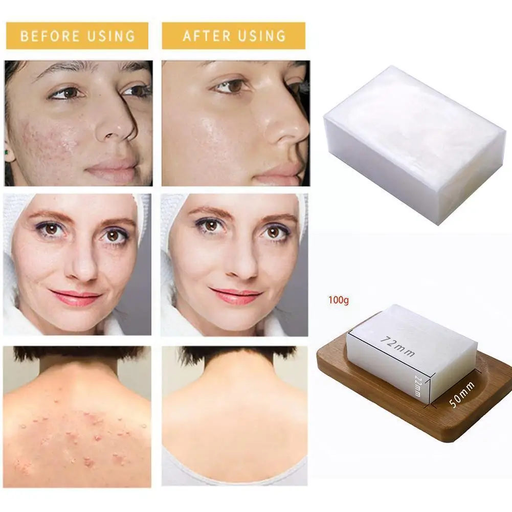 

100g Handmade Natural Kojic Acid Remove Acne Soaps Smooth Wash Glutathione Soap Hand Whitening Soap Bath Skin Cleans G8g4