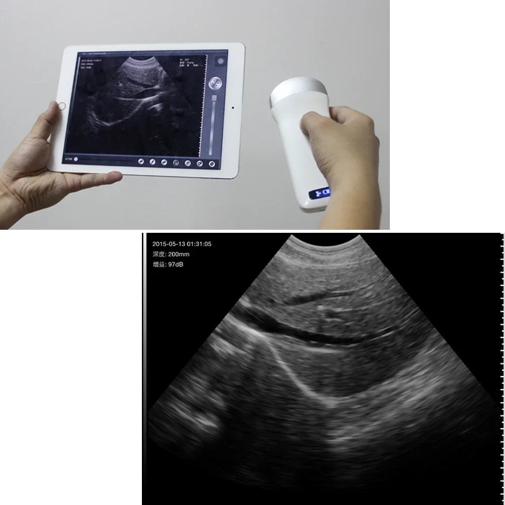 Беспроводной ультразвуковой сканер 80E выпуклый зонд 3 2 МГц с поддержкой IOS Android