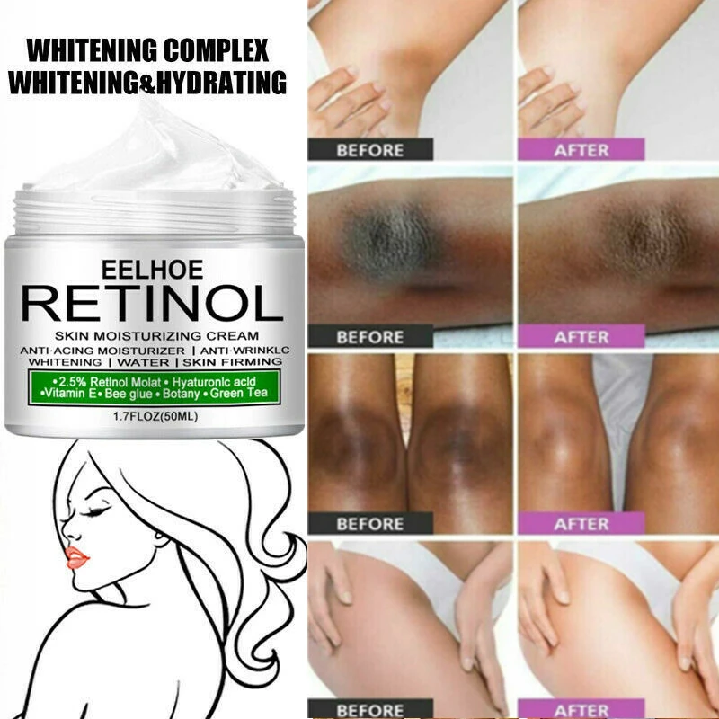 

Отбеливающий крем для подмышек, ног, колен, локтей, частные детали, отбеливание, подмышки, крем, женский уход за кожей