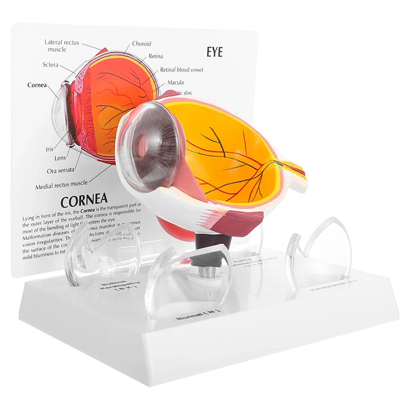

Eyeball Model Eyeball Disease Model Keratopathy Eyeball Model Medical Teaching Textbook Model