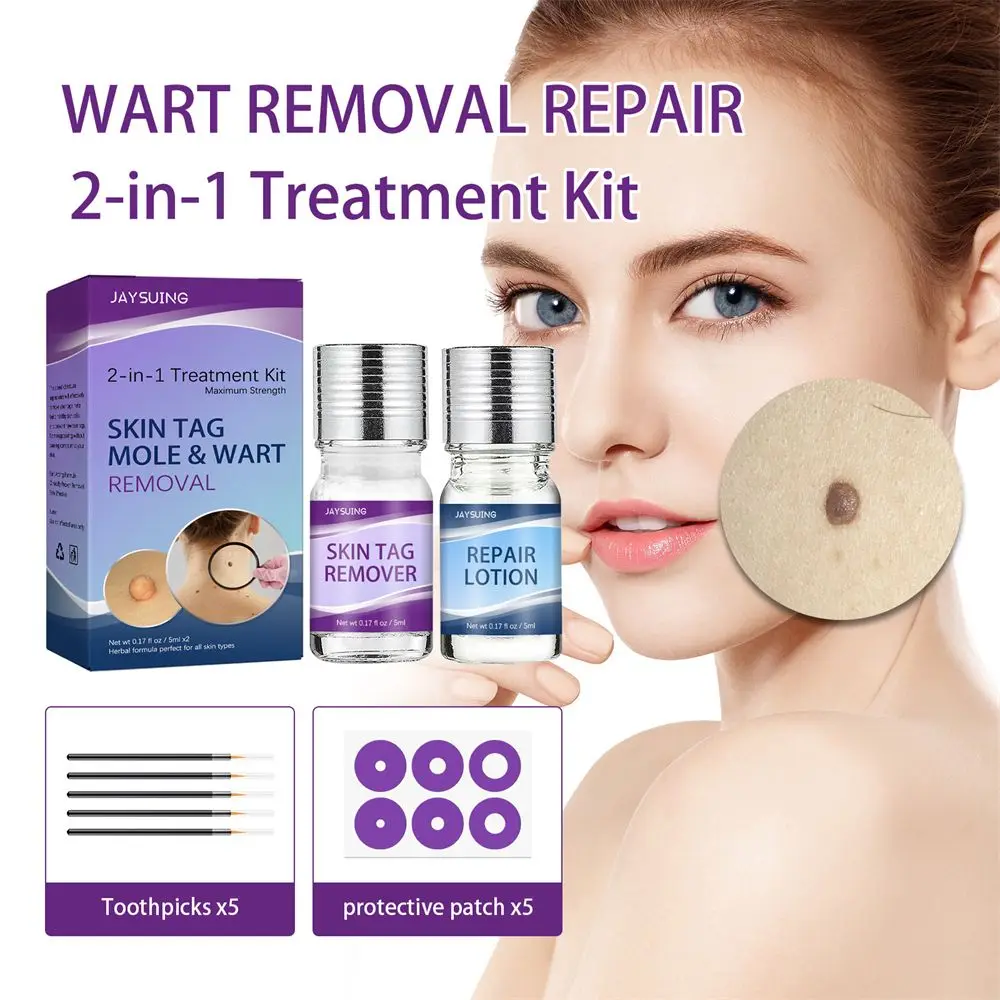 

Unisex Warts Remover Kit 2 In 1 Treatment Skin Tags Removal Set Effective Removing Against Moles Anti Verruca Remedy Body Care