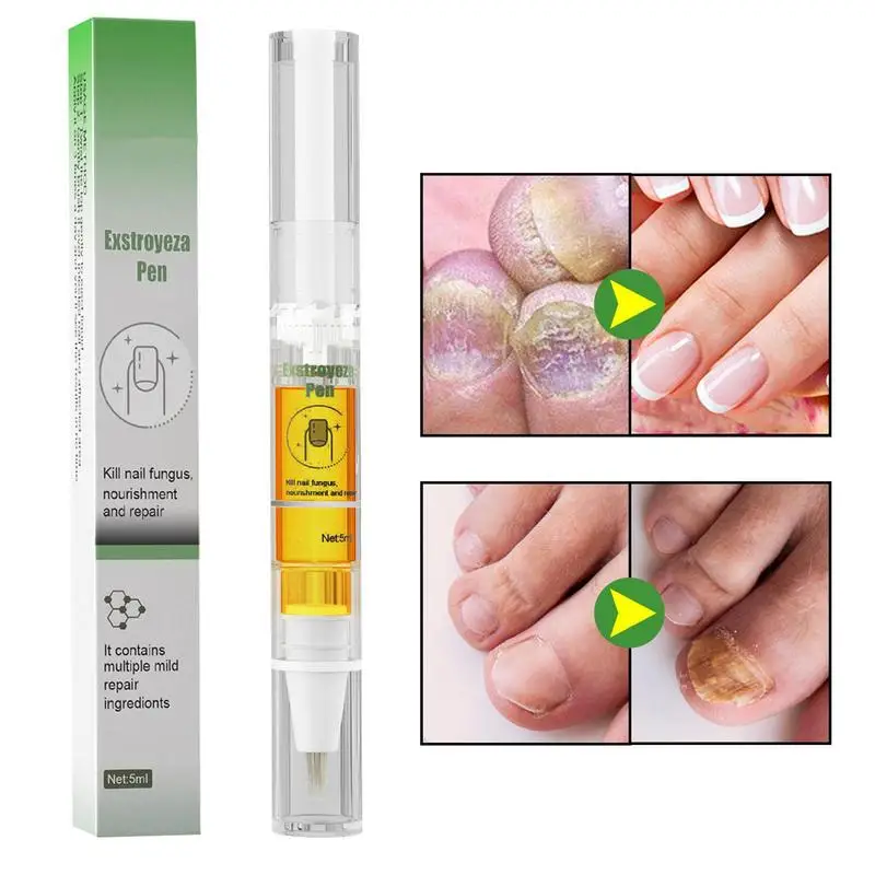 

Жидкий Восстанавливающий раствор для ногтей, восстанавливает и питает ломкость ногтей