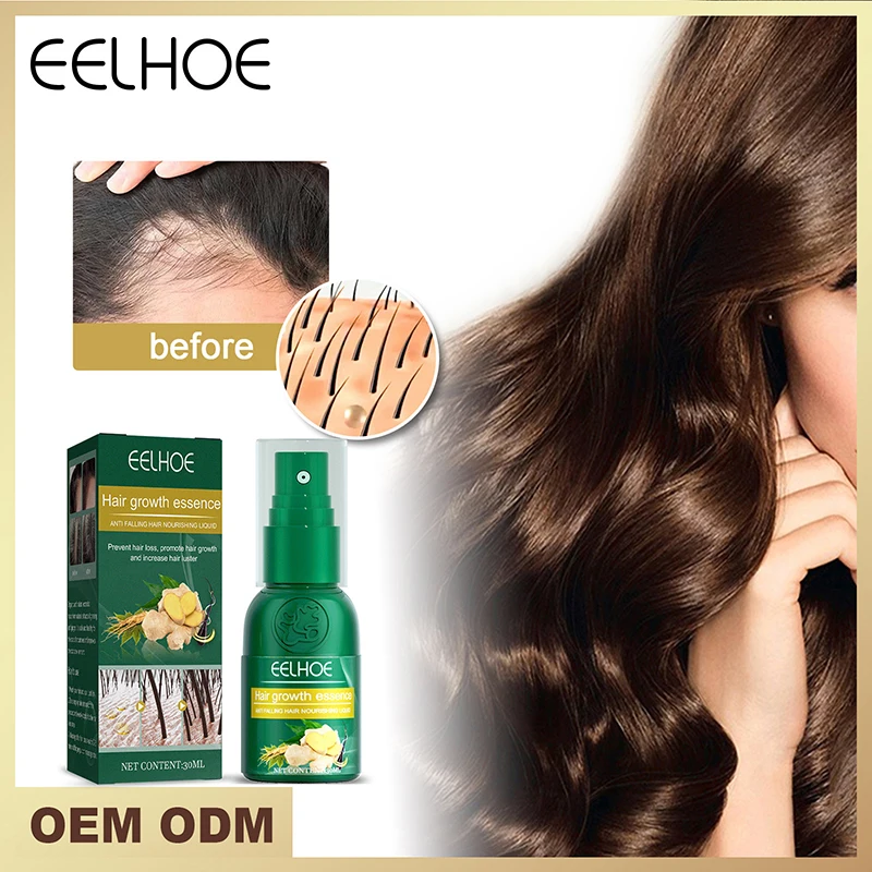 

Имбирный спрей для роста волос, натуральная Сыворотка против выпадения волос, предотвращает облысение, быстрое питание, продукты для ухода за поврежденными волосами