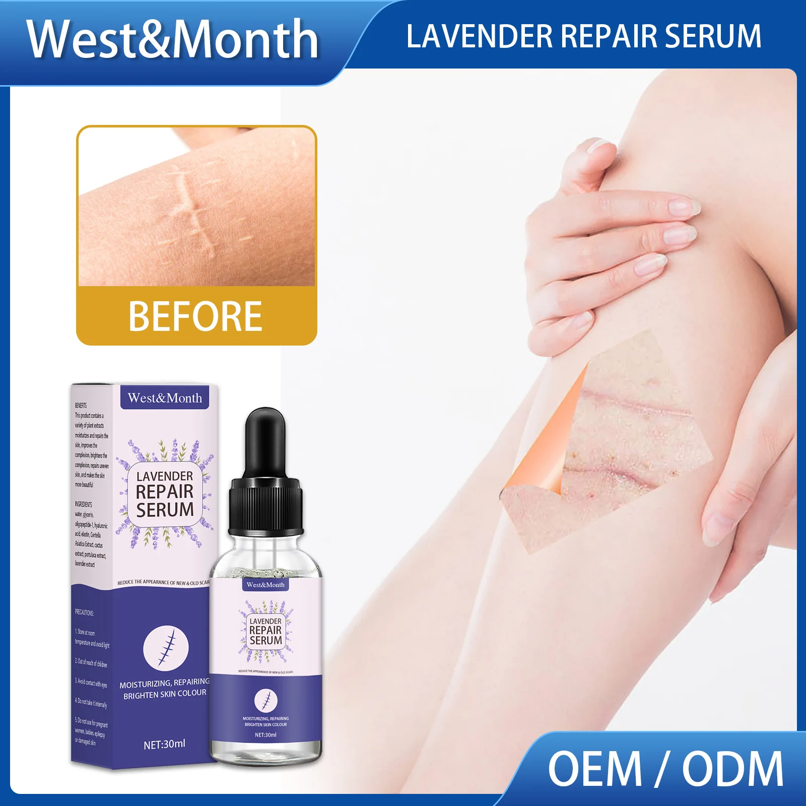 

Лавандовый шрам, восстанавливающий эссенцию, оспа, разбавляющий хирургический шрам, восстанавливающий гладкую кожу, эссенция для удаления ...