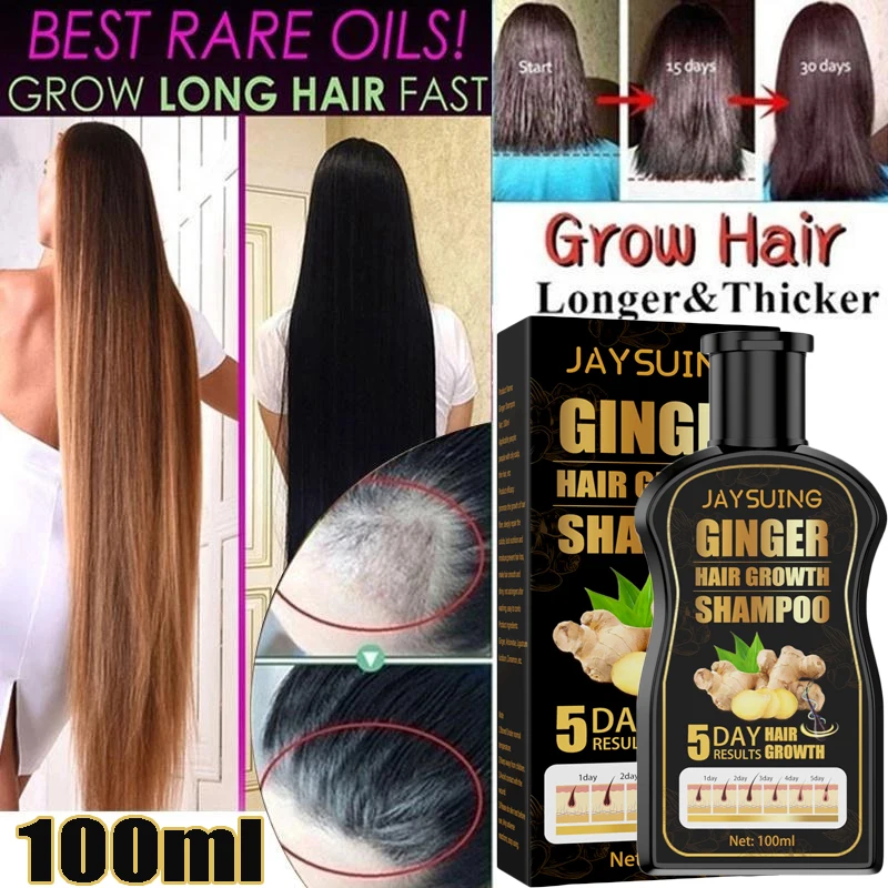 

5 Days Fast Hair Ginger Shampoo for Hair Growth and Hair Loss Prevents Scalp Treatments Thinning Hair for Men and Women 100ml