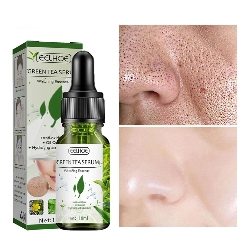 Oil Control Remove Dark Spots Improve Acne Blackheads Dry Skin Firm Care Korean Cosmetics 10ml