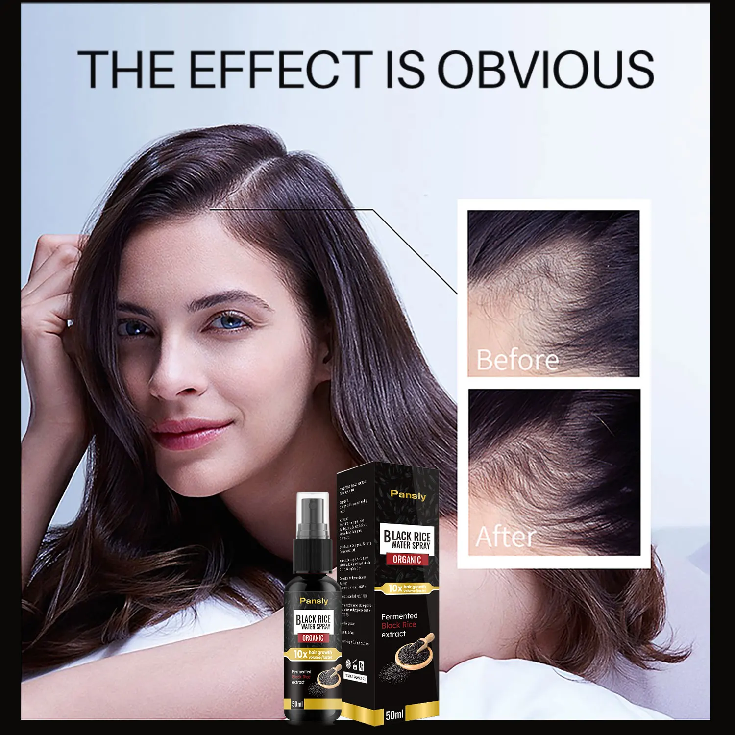 

50ml Black Rice Hair Growth Spray Fast Growing Hair Regrowth Essence Prevent Hair Loss Oils Scalp Repair Treatment For Men Women
