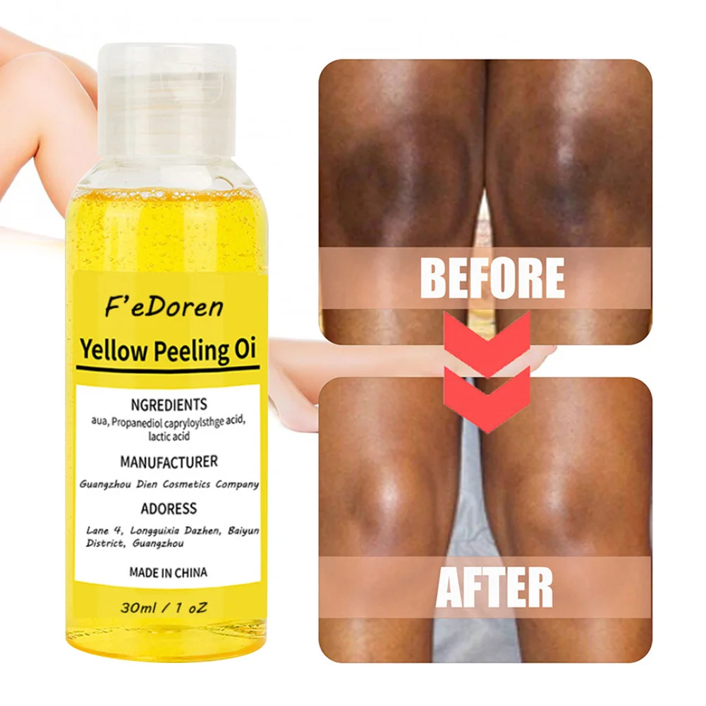 

Yellow Body Peeling Oil Lighten Dark Spots Acne Melanin Skin Bleaching Peeling Oil For Body Skin Exfoliating Moisturizing Oil