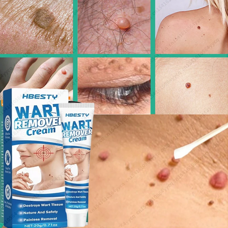 

Skin Tags Remover Serum Painless Mole Skin Dark Spot Warts Remover Serum Freckle Face Wart Tag Treatment Removal Essential Cream