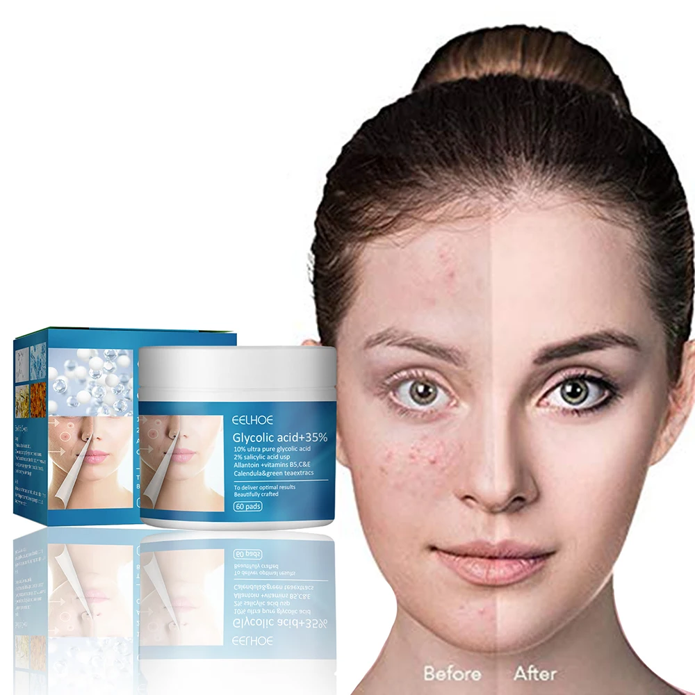 

Glycolic Acid Acne Pads Exfoliating Resurfacing Reduce Pores Complexion 60pcs 60pcs for All Kind Skin Effective MH88