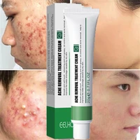 acne removal treatment cream herbal aloe anti acne fade acne scar marks facial gel shrink pores oil control whitening skin care