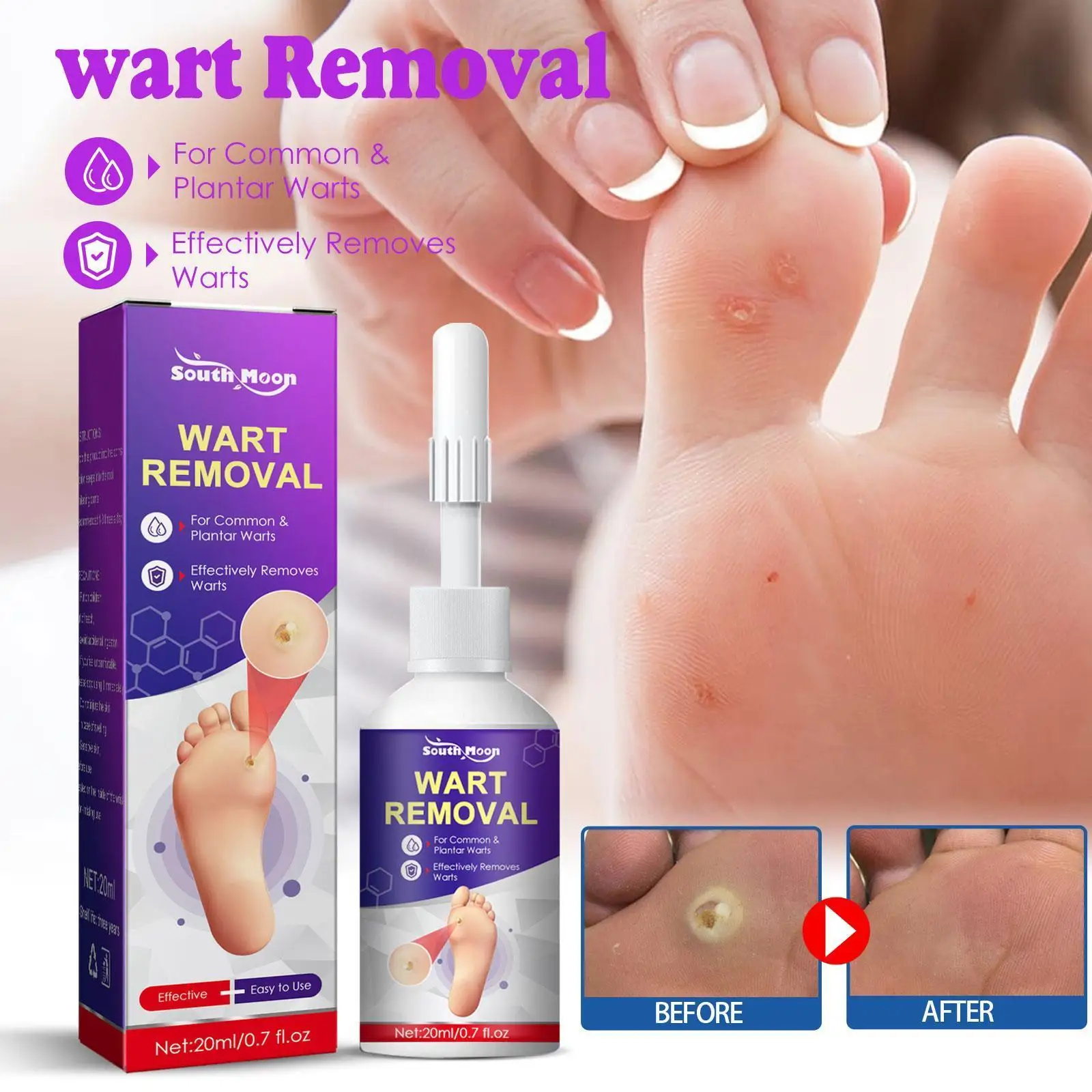 

20ml Skin Tag Removal Treatment Liquid Fast Wart Removal Treatment Acne Foot Corn Anti Spot Lotion R8z8