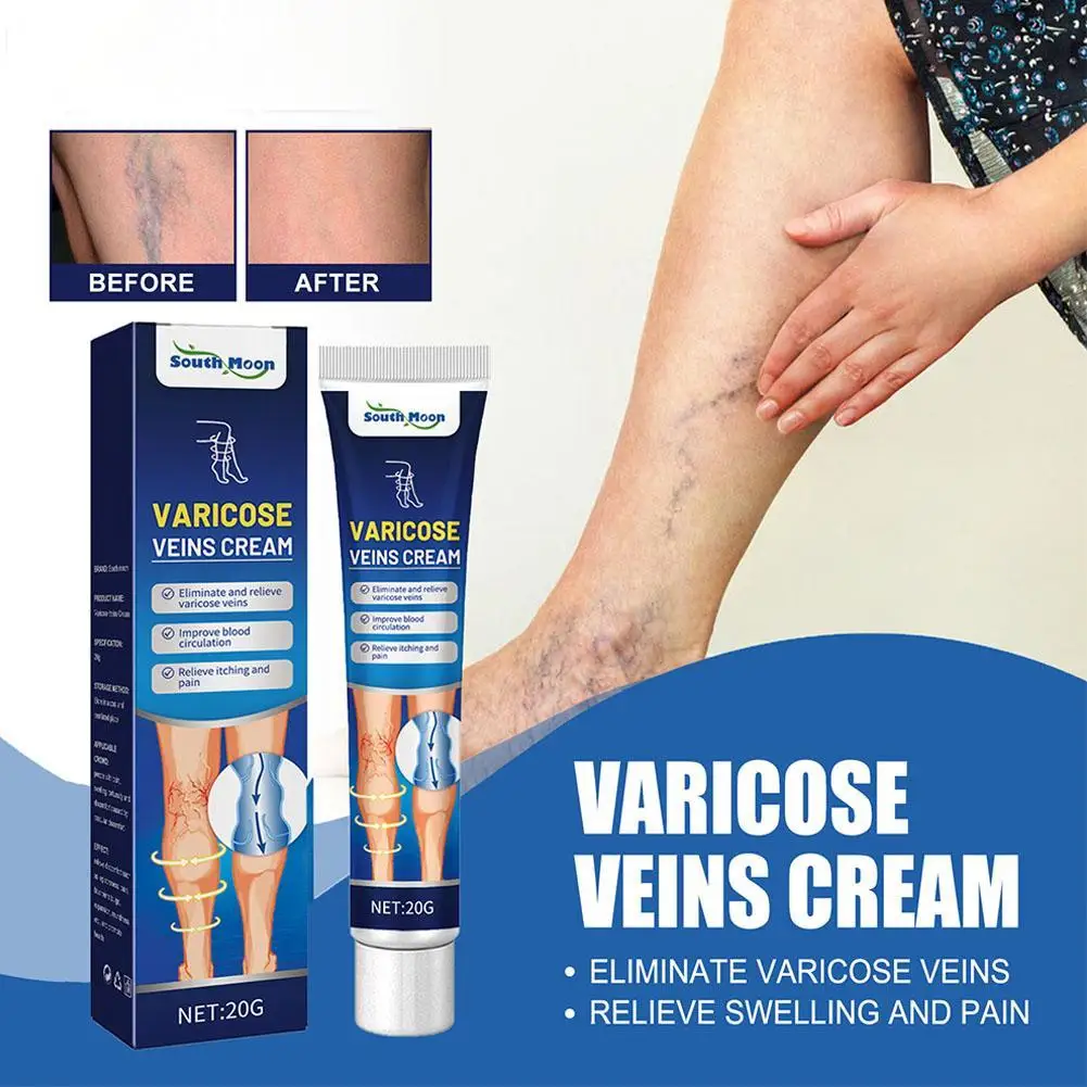 

Venous Massage Varicose Cream Relieves Leg Vascular Protrusion, Varicose Veins, Earthworm Leg Repair Tool