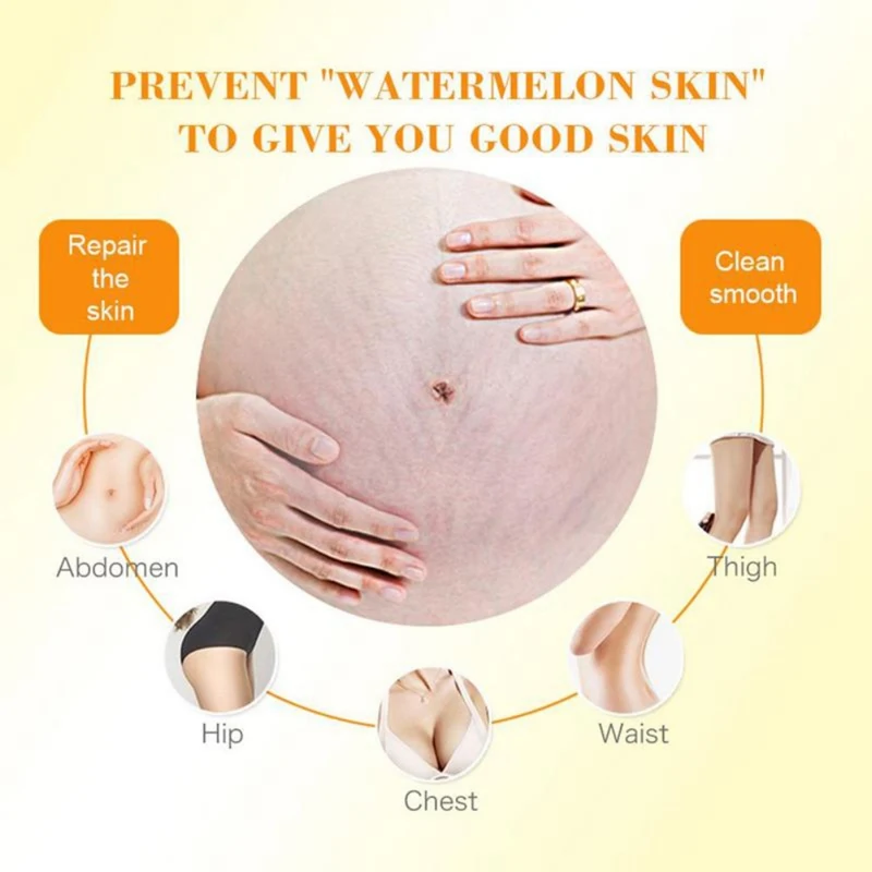 30g Body Stretch Mark Removal Creams Pregnancy Scar Obesity Pattern Promote Cell Regeneration Repair Enhance Skin Elasticity |