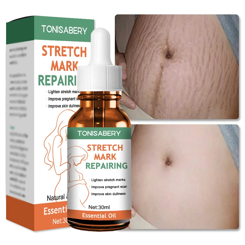 

Крем от растяжек и морщин, 30 мл