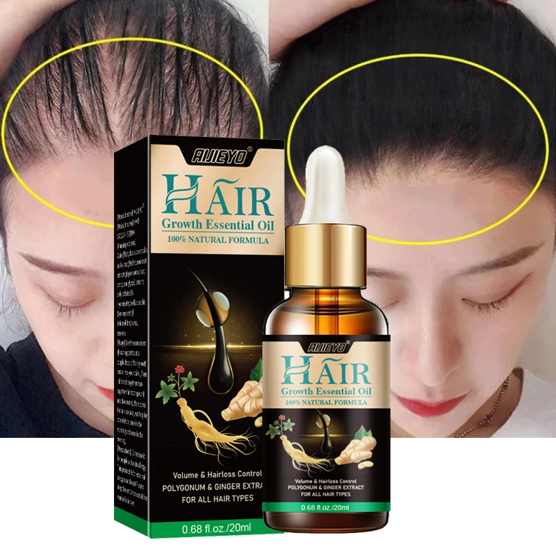 Ginger Hair Growth Essential Oil Effectives Repair Scalp Damaged Anti Loss Thick Fast Growing Nourish Beauty Natural Hair Care