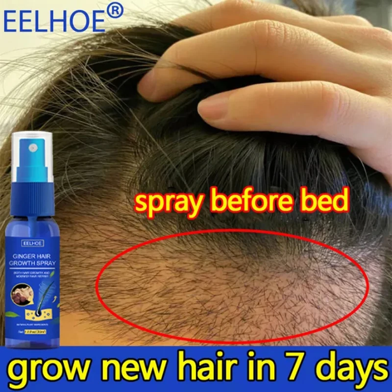 

Hair Growth Spray Promote Fast Thicker Longer Ginger Extract Prevent Baldness Moisturize Scalp Anti Hair Loss Treatment Oil 30ml