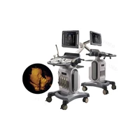 sy a046 ultrasound diagnostic equipment 4d color doppler ultrasound system machine