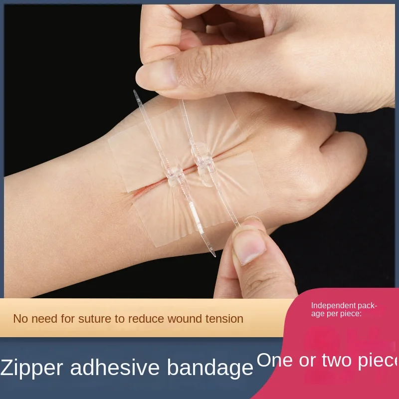 

Zipper Band-Aid Post Reduction Tensiometer Wound Patch Sewing Free Joint Needle Scar Skin Postoperative Wound