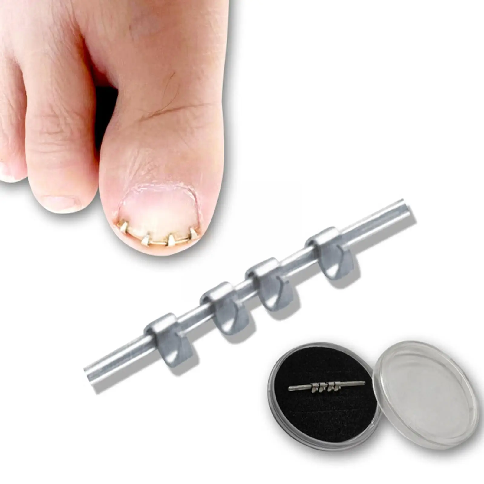 

Professional Ingrown Toe Nail Correction Wire Fixer Treatment Corrector Pedicure Recover Paronychia 1PCS Reusable Toenails G0P8