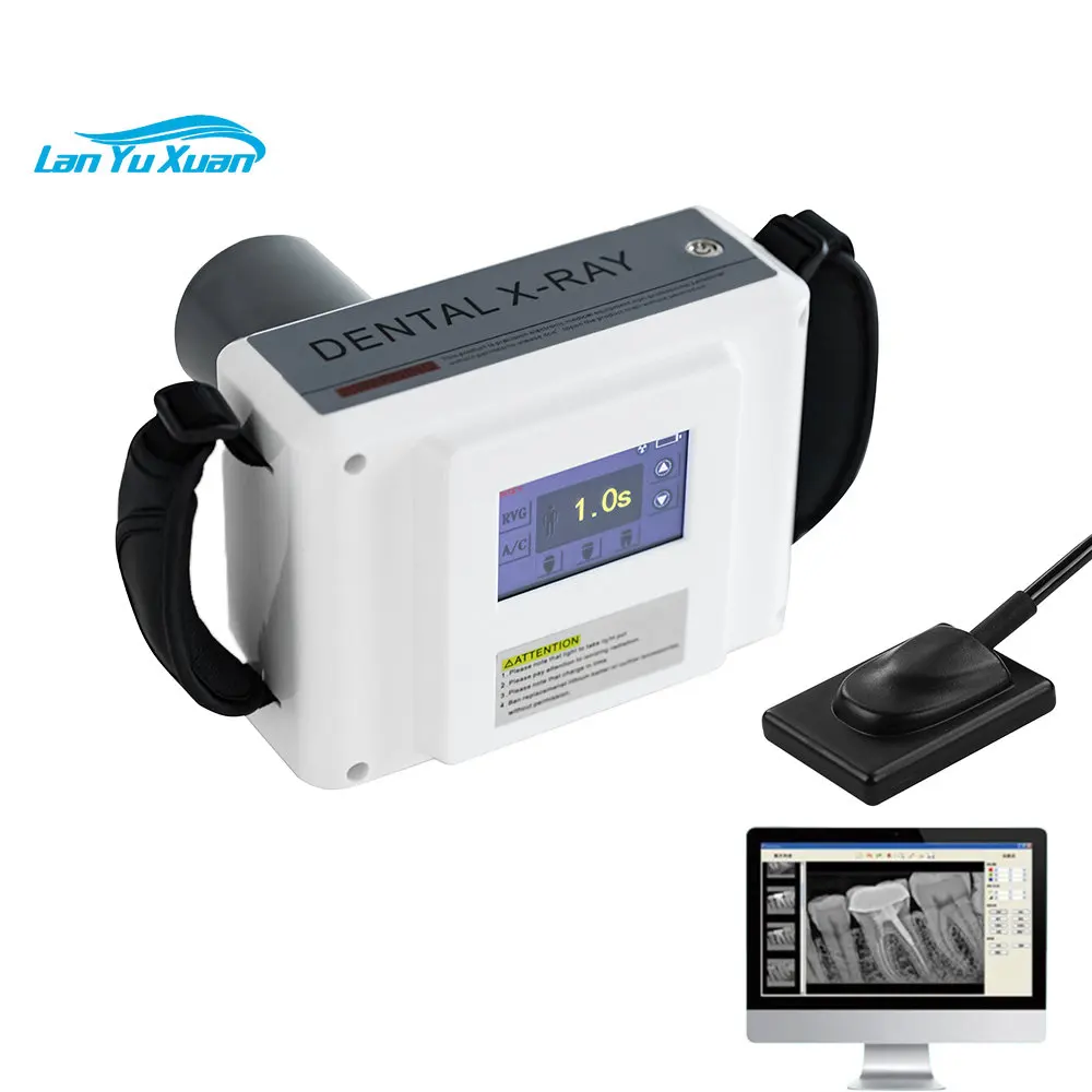 

S701 High frequency China Equipment Handheld Rx Portable Portatil Digital Periapical Xray with Sensor