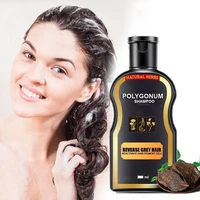 1pcs hair loss treatment shampoo hair care shampoo bar ginger hair growth cinnamon anti hair loss shampoo polygonum multiflorum