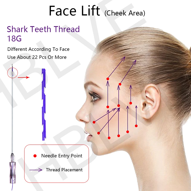 

Korean Pdo Pcl Lifting Thread V-line Facial 18g 19g Strong Face Lift Long-lasting Molding Cog Shark Pdo Pcl Plla Threads