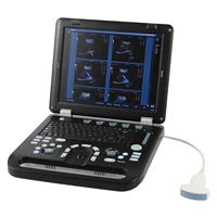 sunbright ultrasound scanne portable clinical 4d color doppler medical ultrasound instruments sun906b