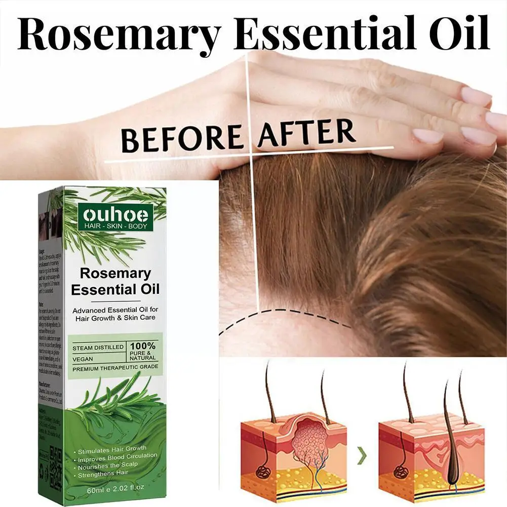 

30ml Rosemary Essential Oil 100% Pure Natural Therapeutic Grade For Hair Growth Coconut Oil Hair Serum D0B9