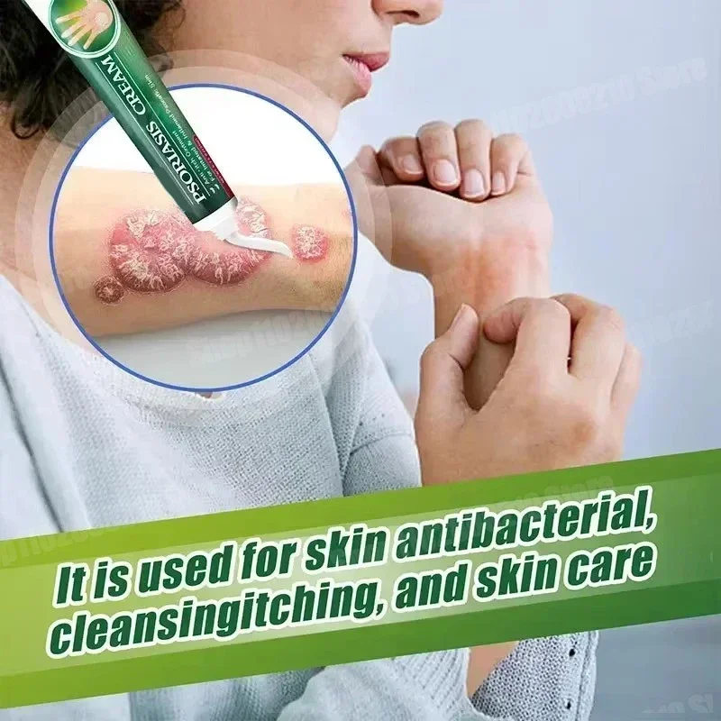 Antibacterial Cream Psoriasis Anti-itch Relief Eczema Skin Rash Urticaria Desquamation Healing