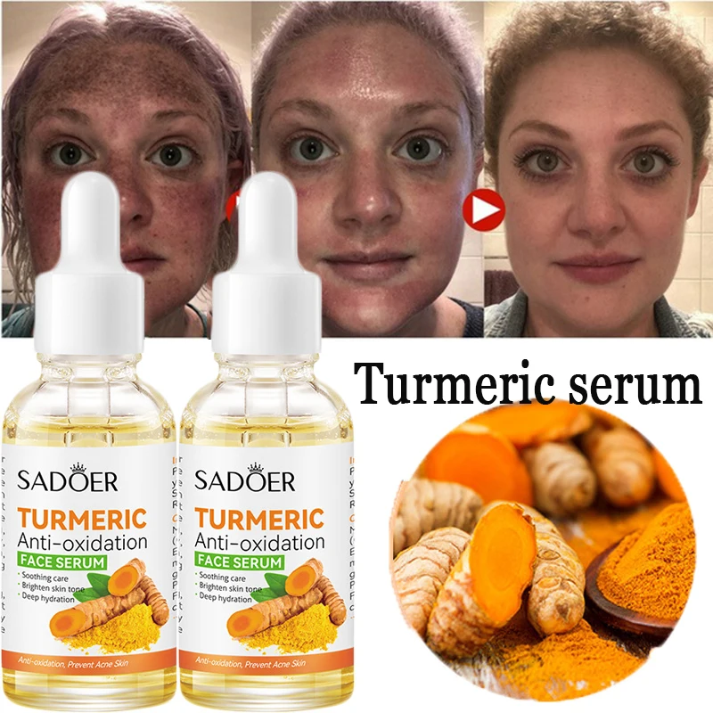 

Куркума, антиоксидантная отбеливающая сыворотка, лечение акне, удаление темных точек, подтяжка морщин, уход за кожей против старения и выцв...