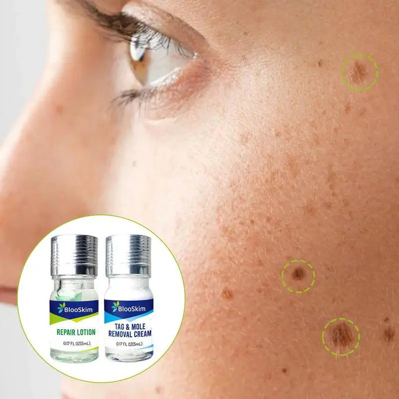 

Прибор для удаления родинок Восстанавливающий лосьон, средство для удаления родинок и этикеток на коже, натуральные не раздражающие жидкие кроты, легкое удаление этикеток и крот на коже