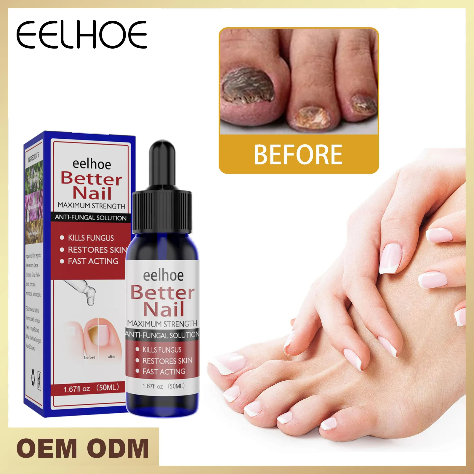 

Nail Repair Serum Nail Fungal Treatment Serum Onychomycosis Paronychia Anti-Fungal Nail Infection Toe Fungus Foot Repair Care